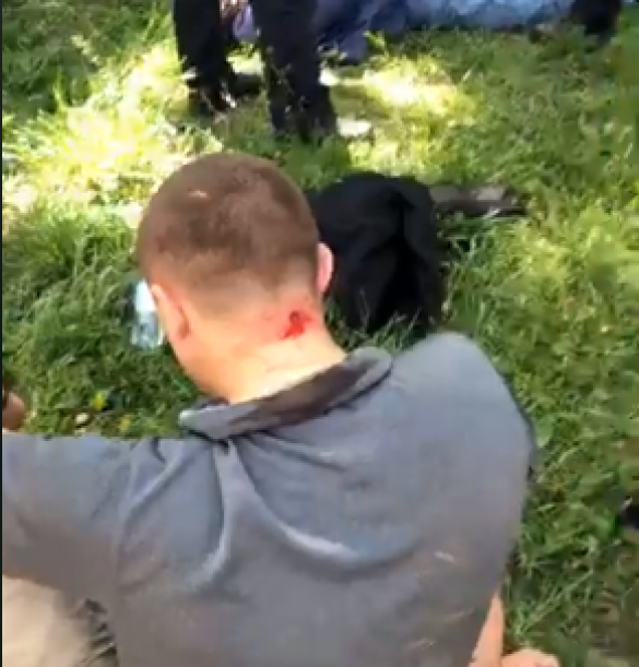 Лидеру одесских «правосеков» выстрелили в затылок (ФОТО, ВИДЕО)  | Русская весна