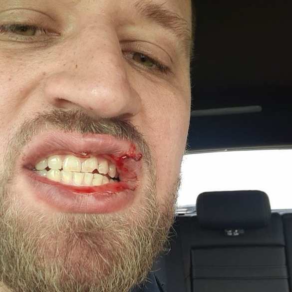 Это Украина: в центре Киева депутат избил «ветерана АТО» (ФОТО, ВИДЕО) | Русская весна