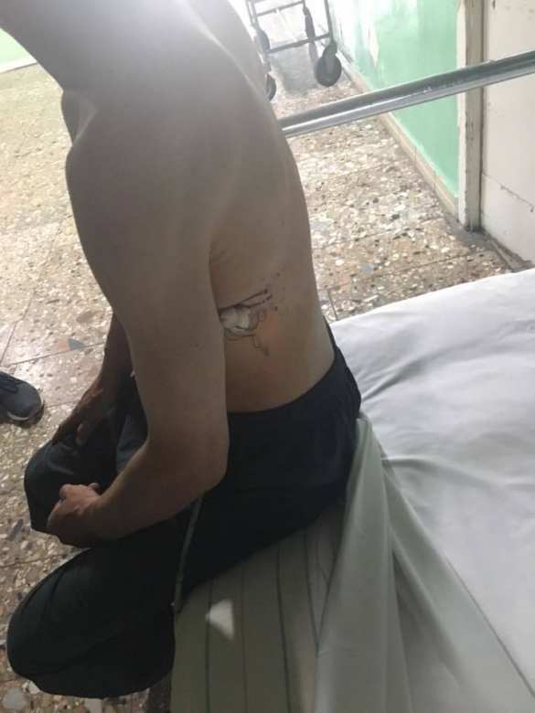 Пытали и два года держали в сарае: на Украине воспитанник интерната попал в рабство (ФОТО) | Русская весна