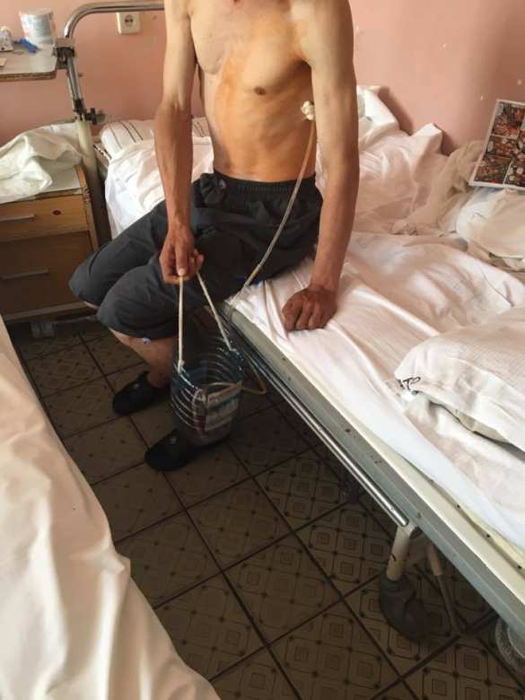 Пытали и два года держали в сарае: на Украине воспитанник интерната попал в рабство (ФОТО) | Русская весна