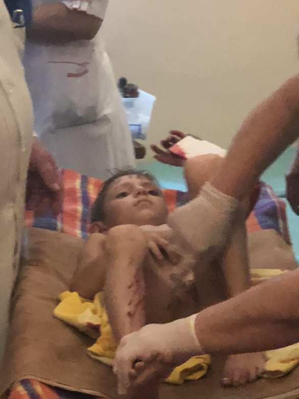 СРОЧНО: В Горловке дети и бабушка подорвались на гранате (ФОТО, ВИДЕО) | Русская весна