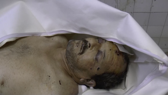 Снайперы террористов начали кровавую охоту на жителей Алеппо, в Латакии банды готовятся к наступлению на г. Сальма (ФОТО 18+) | Русская весна