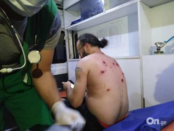 Спецназ открыл огонь по протестующим в Тбилиси (ВИДЕО, ФОТО 18+) | Русская весна