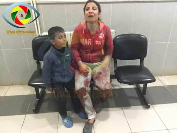 Кровавая ночь в Африне: после турецкого обстрела убиты и ранены дети, в больнице идут операции (ФОТО, ВИДЕО 18+) | Русская весна