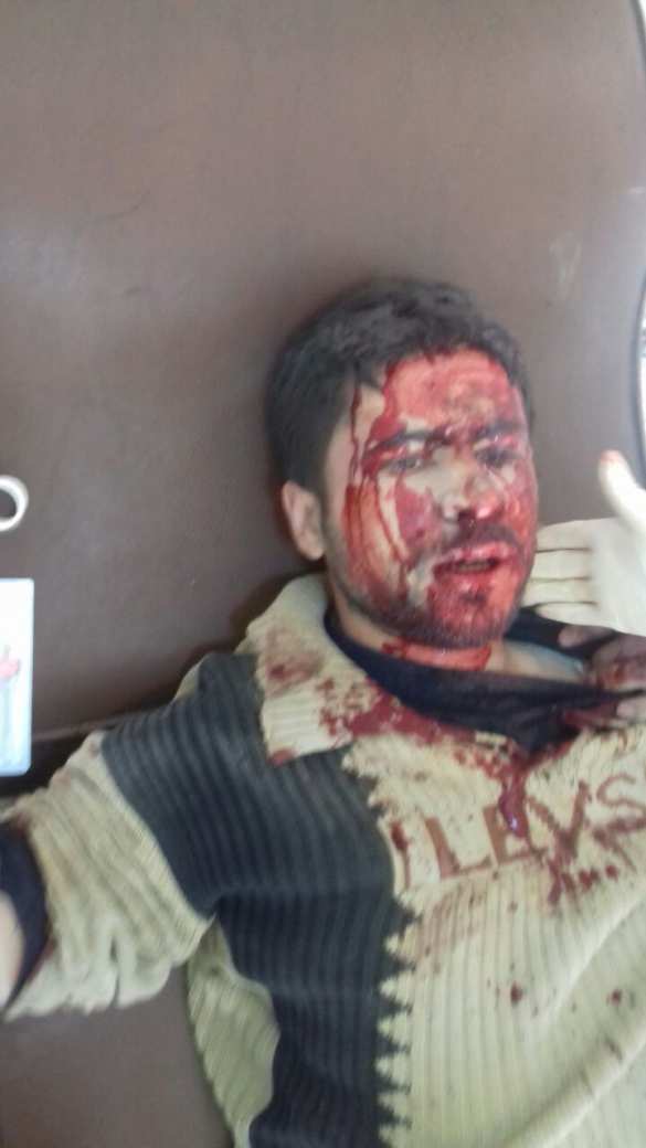 СРОЧНО: «Ан-Нусра» штурмует жилой квартал в Алеппо, боевики вклинились в оборону YPG на 300 м (ФОТО) | Русская весна