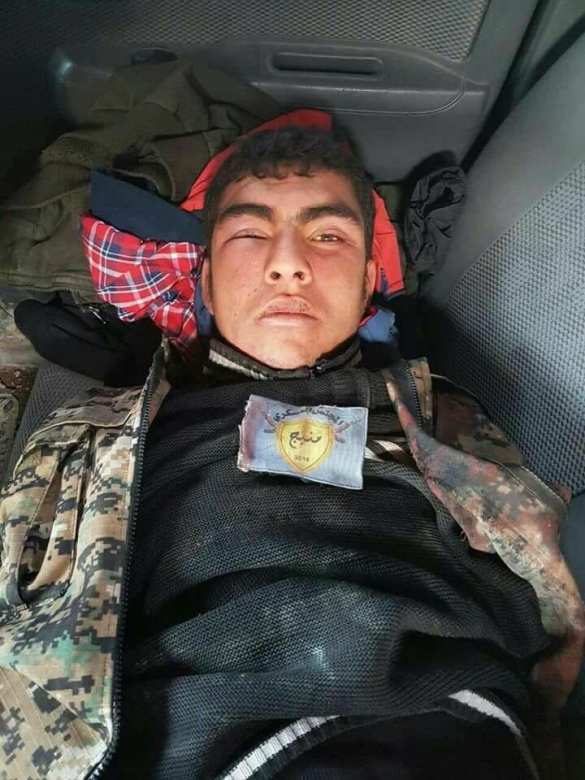 Жестокие бои в Алеппо: Турки и курды убивают друг друга (ФОТО 18+) | Русская весна