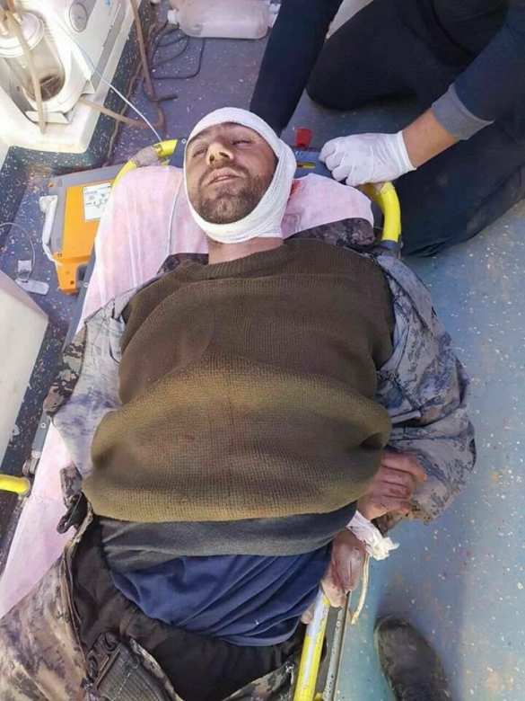 Жестокие бои в Алеппо: Турки и курды убивают друг друга (ФОТО 18+) | Русская весна