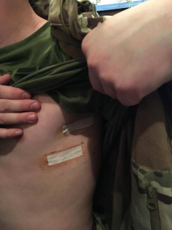 «Нужны поилки и пелёнки»: В Харьков доставлена партия раненых боевиков «АТО» (ФОТО) | Русская весна