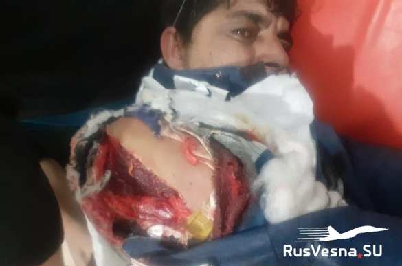 Страшные кадры: враг нанёс смертоносные удары по северу Сирии (ФОТО) | Русская весна