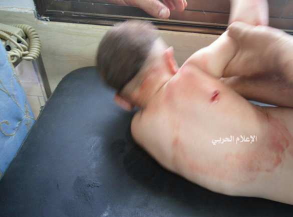 Бойня в Алеппо: Армия Сирии и ВКС России продолжают уничтожать боевиков — подробности операции (ФОТО, ВИДЕО 18+) | Русская весна