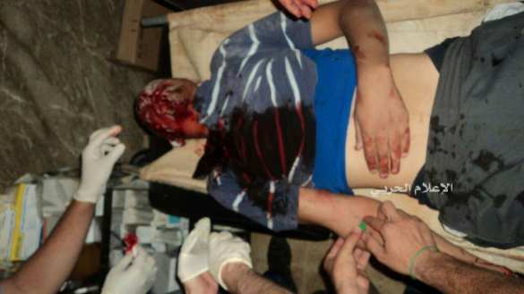 Масштабное наступление террористов: за день убито 270 сирийцев, сотни ранены (ФОТО 18+) | Русская весна