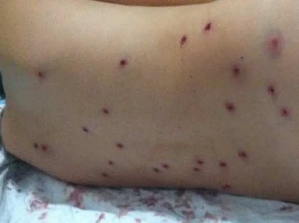 На Украине ребёнка расстреляли из дробовика на горке прямо у школы (ВИДЕО, ФОТО 18+) | Русская весна