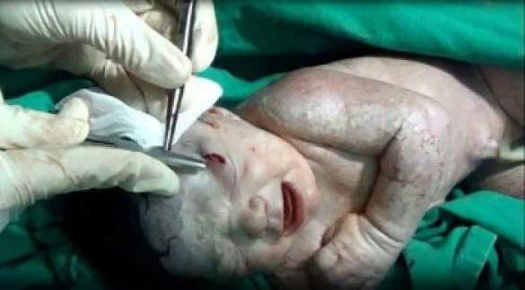 В Сирии родилась девочка с осколком снаряда в голове (ФОТО,ВИДЕО) | Русская весна