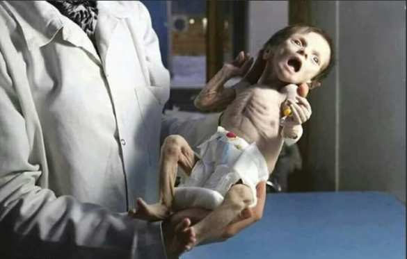 Horrendous footage filmed near Damascus: Who kills Syrian babies? (PHOTO 18+) | Русская весна