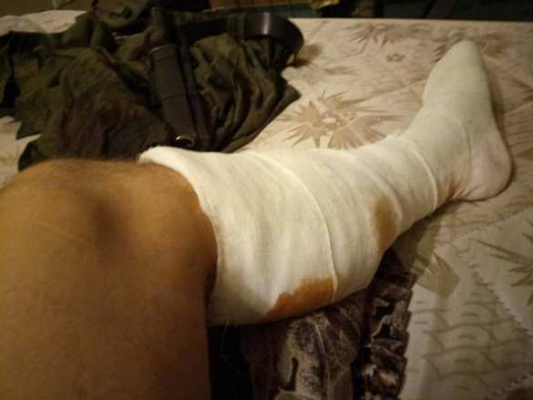 Ранен сербский ополченец Деки (ФОТО) | Русская весна