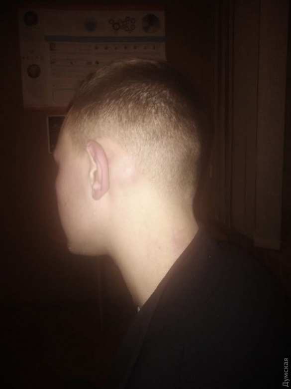 «Я чувствую себя в опасности»: в Одессе напали на «патрiота-активиста» (ФОТО) | Русская весна