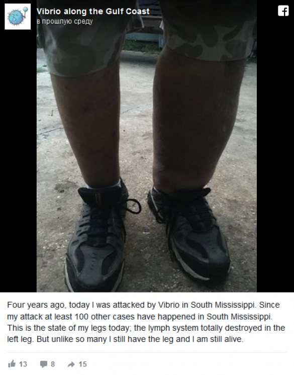 После разлива нефти BP жителям США угрожает смертельная бактерия (ФОТО) | Русская весна