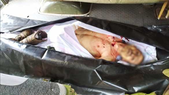 Защитники Донбасса накрыли группу боевиков ВСУ, живыми ушли не все (ФОТО 18+) | Русская весна