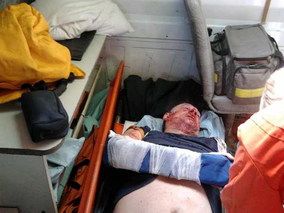 На Украине жестоко избили противника Порошенко (ФОТО) | Русская весна