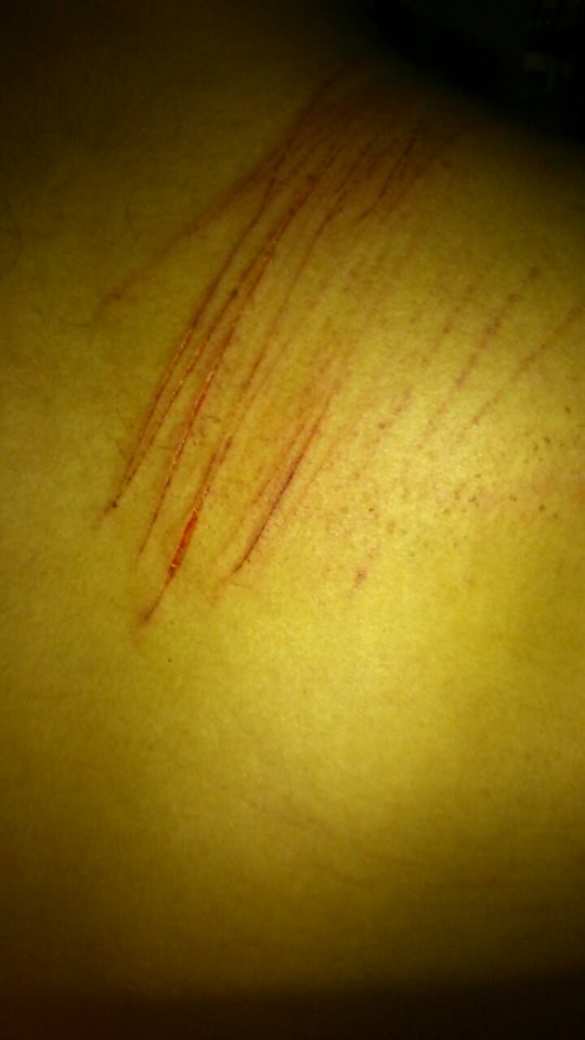 Вместо суда «боевых педофилов» из «Торнадо» жестоко избили (+ФОТО) | Русская весна