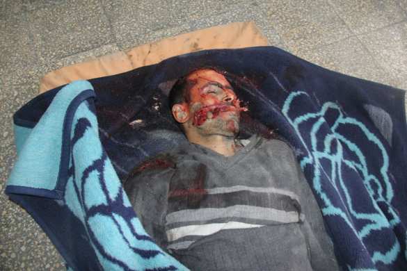 ВАЖНО: Получив подкрепление из Турции, «Ан-Нусра» наступает на курдов и САА в Алеппо (ВИДЕО, ФОТО 18+) | Русская весна