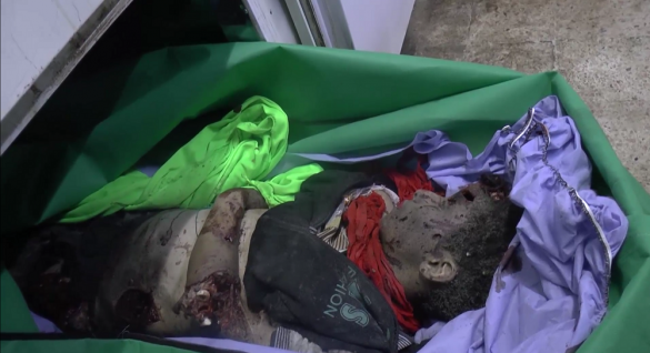 Ужасающие кадры: террор в Алеппо продолжается, боевики уничтожают мирное население (ВИДЕО, ФОТО 21+) | Русская весна