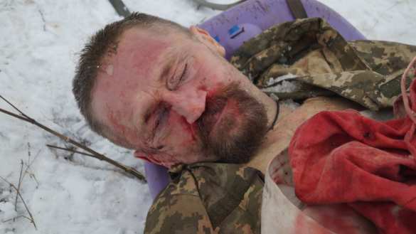 ВАЖНО: ВСУ понесли потери при попытке прорыва позиций ВС ДНР — экстренное заявление (ФОТО, ВИДЕО строго 21+) | Русская весна