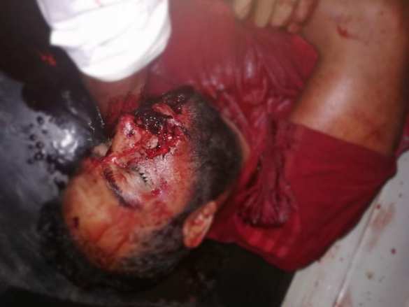 МОЛНИЯ: Страшный взрыв и бой в Сирии — атакован объект армии Турции (ФОТО 18+) | Русская весна