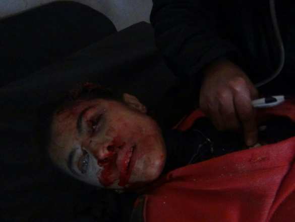 СРОЧНО: «Ан-Нусра» и умеренная оппозиция перешли в наступление в Алеппо, «адским огнем» убиты и ранены 100 мирных жителей (ФОТО 18+) | Русская весна