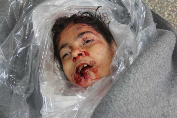 Шокирующие кадры: террористы в Алеппо убивают детей и женщин (ВИДЕО, ФОТО 21+) | Русская весна