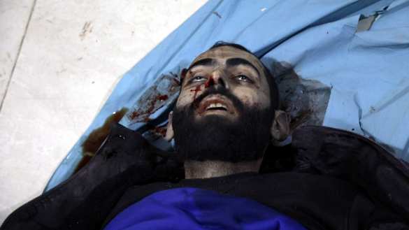 Жуткие кадры: Враг нанёс удар по самому крупному городу Сирии (ФОТО 18+) | Русская весна