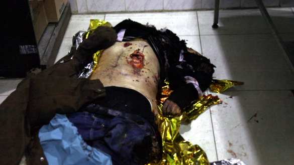 Жуткие кадры: Враг нанёс удар по самому крупному городу Сирии (ФОТО 18+) | Русская весна