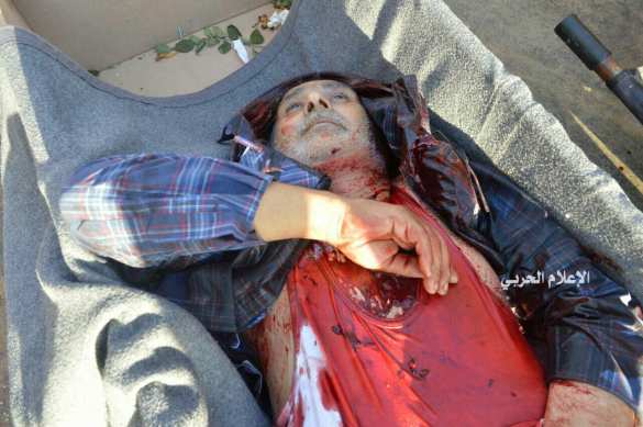 Бойня в Алеппо: Армия Сирии и ВКС России продолжают уничтожать боевиков — подробности операции (ФОТО, ВИДЕО 18+) | Русская весна