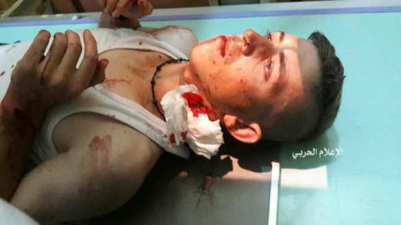 Бойня в Алеппо: Армия Сирии и ВКС России продолжают уничтожать боевиков — подробности операции (ФОТО, ВИДЕО 18+) | Русская весна