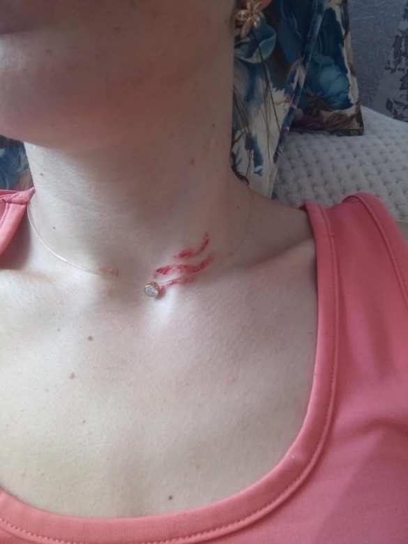 Дикая Украина: Под Ровно продавец едва не задушила покупательницу, которая вошла в магазин без маски | Русская весна