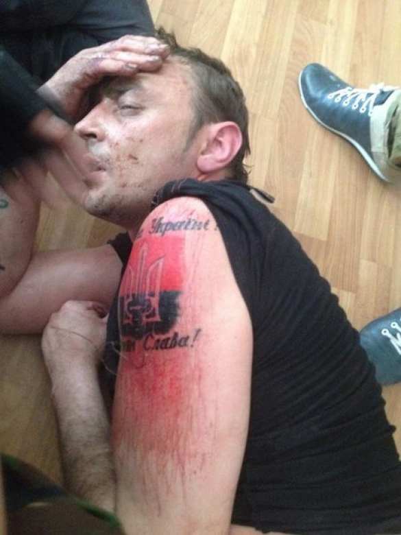 Перед сдачей в плен украинский фашист пытался кирпичом стереть татуировку «Правого сектора» (ФОТО) | Русская весна