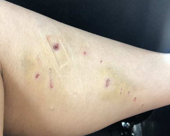 Биолог рассказала, как сумела спастись из пасти крокодила (ФОТО) | Русская весна