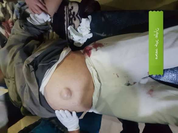 Жуткие кадры: турецкие банды нанесли кровавые удары перед переговорами РФ по Сирии (ФОТО 18+) | Русская весна