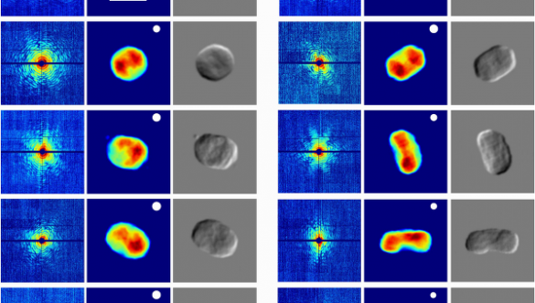 Ускоритель частиц помог ученым сделать первый «рентген» бактерий | Русская весна