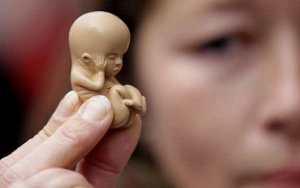 Женщины более здоровы в странах, где аборты ограничены законом | Русская весна