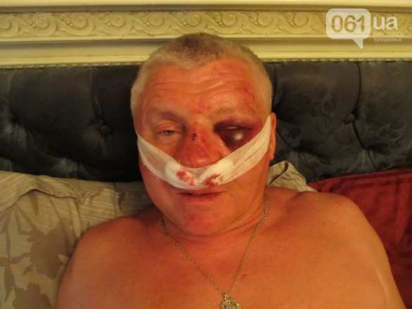 В Запорожье сильно избили видного «правосека» (ФОТО) | Русская весна