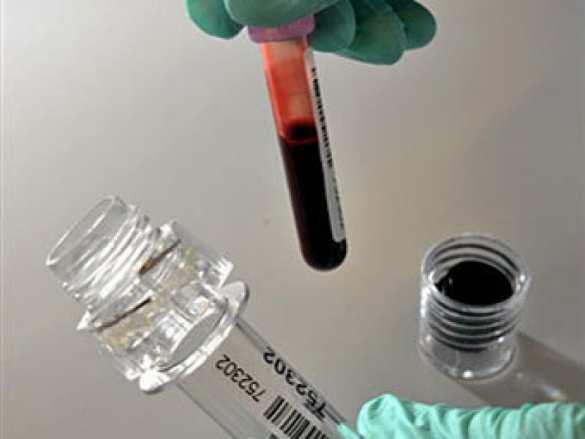 Почти сотня спортсменов употребляла допинг на Олимпийских играх в 2008 и 2012 — новые разоблачения МОК | Русская весна