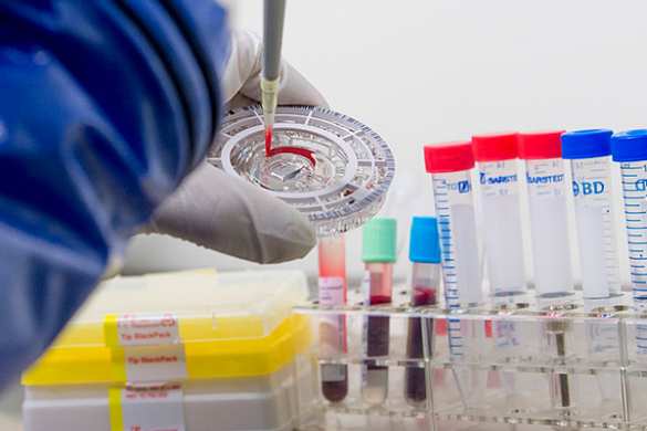 Россиян будут прививать от Эболы перед загранпоездками | Русская весна