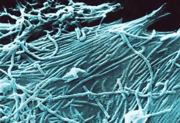 Обама нагнетает: Белый дом грозит миру лихорадкой | Русская весна