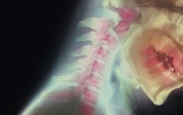 Итальянский нейрохирург заявил о почти полной готовности к пересадке головы (ФОТО) | Русская весна