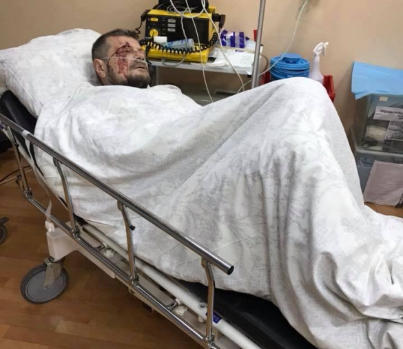 Помощница нардепа Мосийчука рассказала о его состоянии после покушения | Русская весна