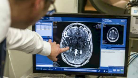 Медики взломали защиту мозга, чтобы вылечить рак (ВИДЕО) | Русская весна