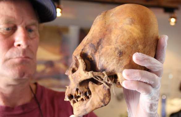 Смартфоны уродуют кости черепа — неожиданные выводы учёных | Русская весна