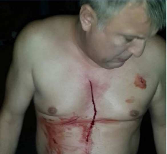 За правду о тысячах убитых под Иловайском совершена попытка убийства режиссера Марка Греся (фото, добавлено видео) | Русская весна