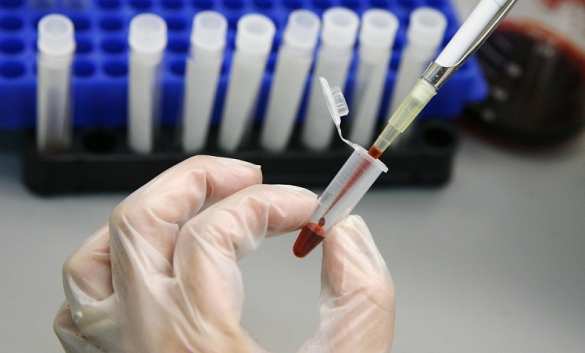 СМИ рассказали о неочевидном признаке смертельного заболевания | Русская весна